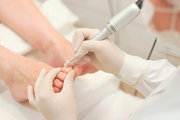 Tratamentos estéticos com base podológica