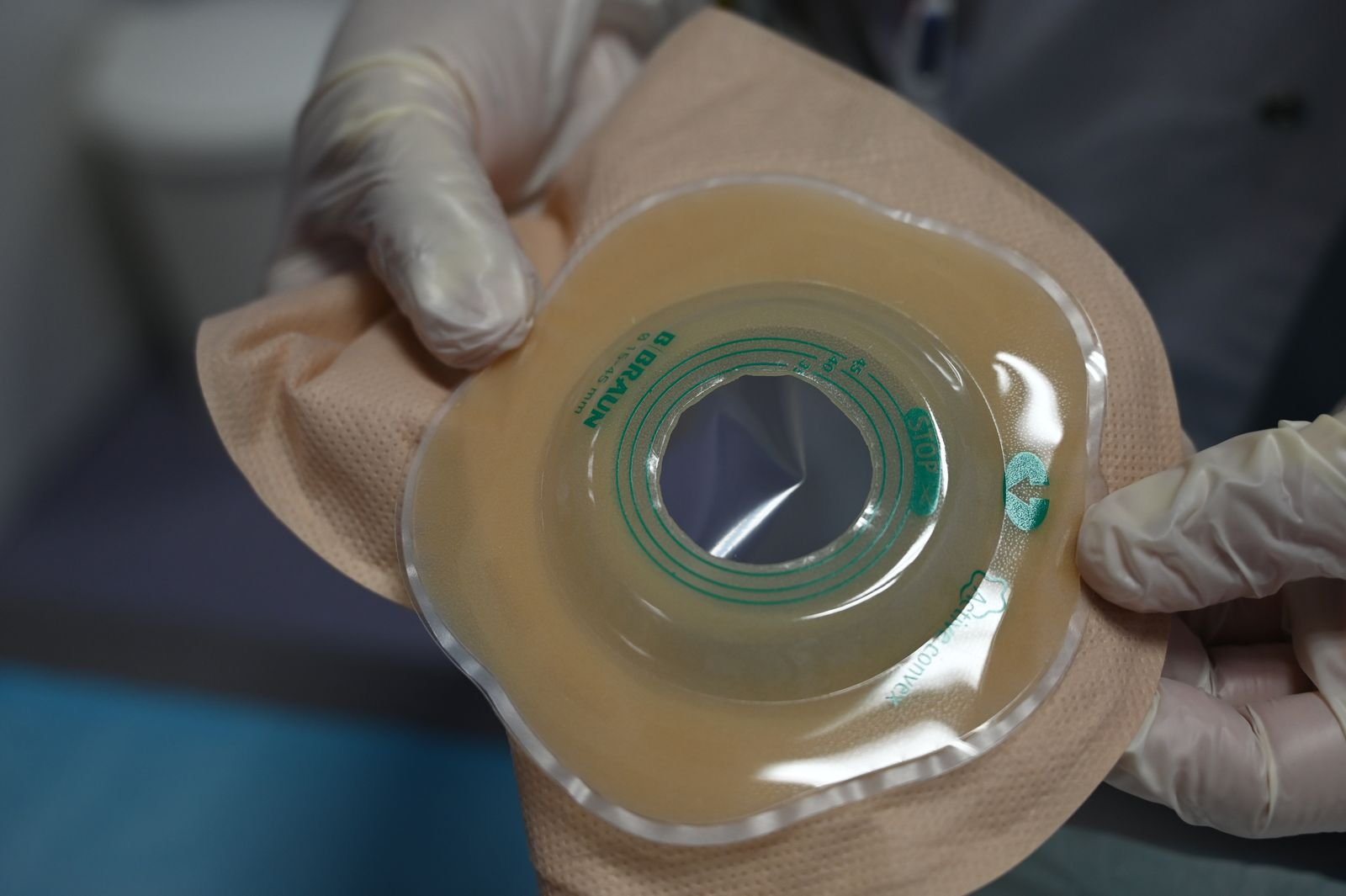 Profissional de saúde segurando uma bolsa coletora de ostomia com luvas