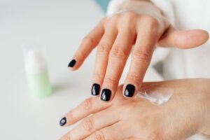 Mulher aplicando creme hidratante na pele extremamente seca das mãos